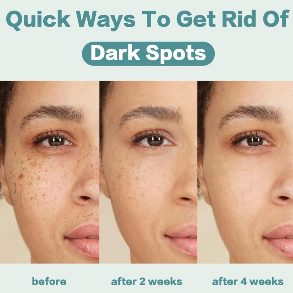 🌿NWT 💚CITYGOO: Dark Spot Corrector Cream - ⭐️Enriching Skin Cream✨️